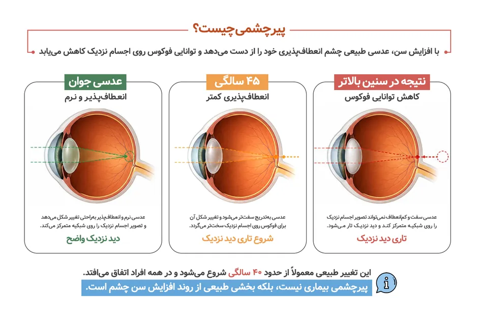 مقایسه چشم در سنین مختلف